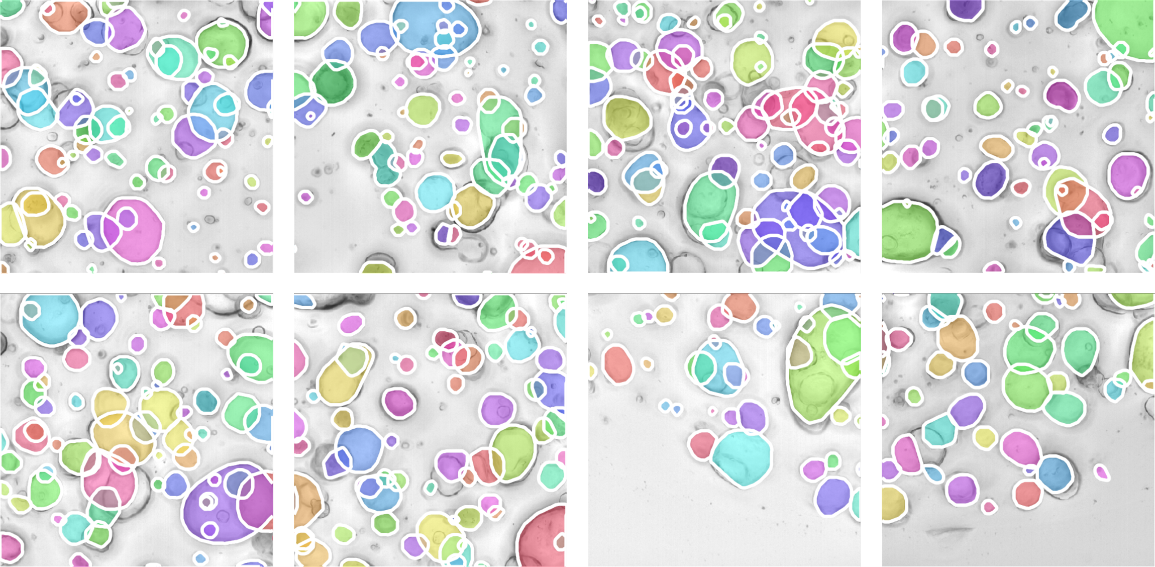 Organoids images and ground-truth instance annotations